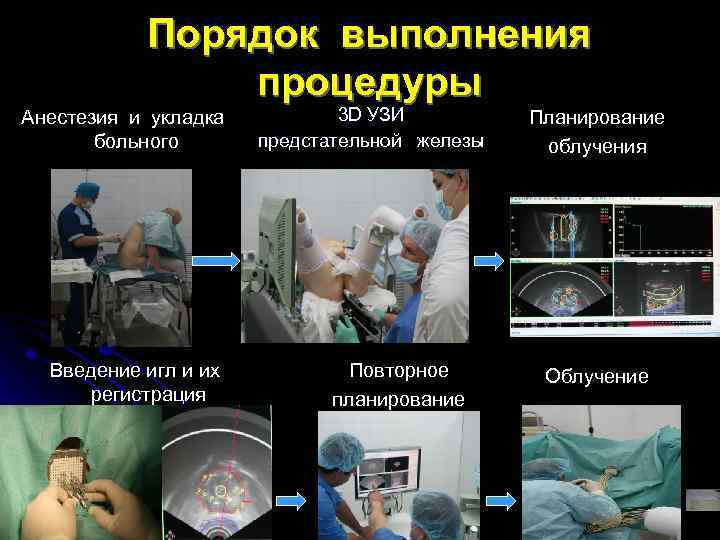 Порядок выполнения процедуры Анестезия и укладка больного Введение игл и их регистрация 3 D