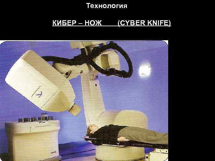 Технология КИБЕР – НОЖ (CYBER KNIFE) 