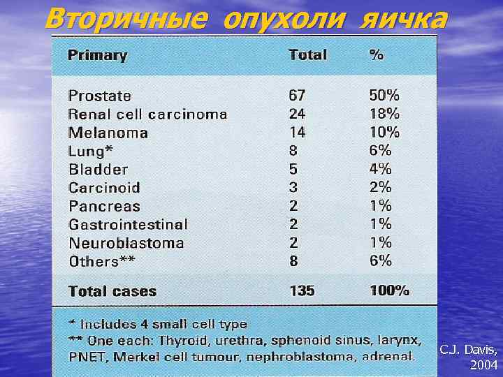 Вторичные опухоли яичка C. J. Davis, 2004 