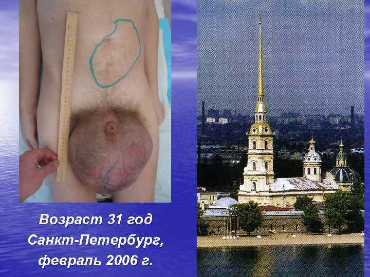 Возраст 31 год Санкт-Петербург, февраль 2006 г. 