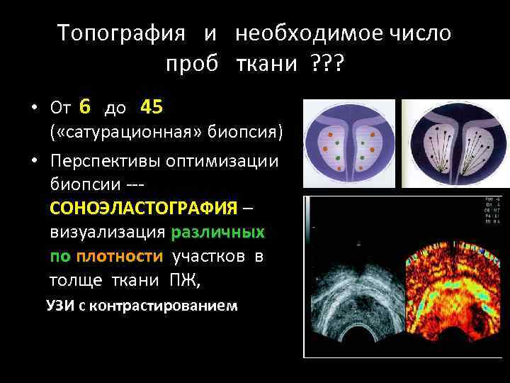 Топография и необходимое число проб ткани ? ? ? • От 6 до 45