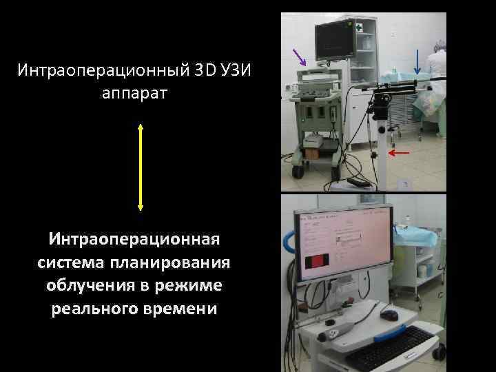 Интраоперационный 3 D УЗИ аппарат Интраоперационная система планирования облучения в режиме реального времени 