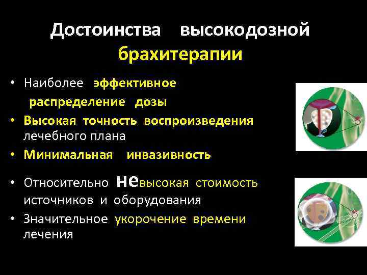 Достоинства высокодозной брахитерапии • Наиболее эффективное распределение дозы • Высокая точность воспроизведения лечебного плана