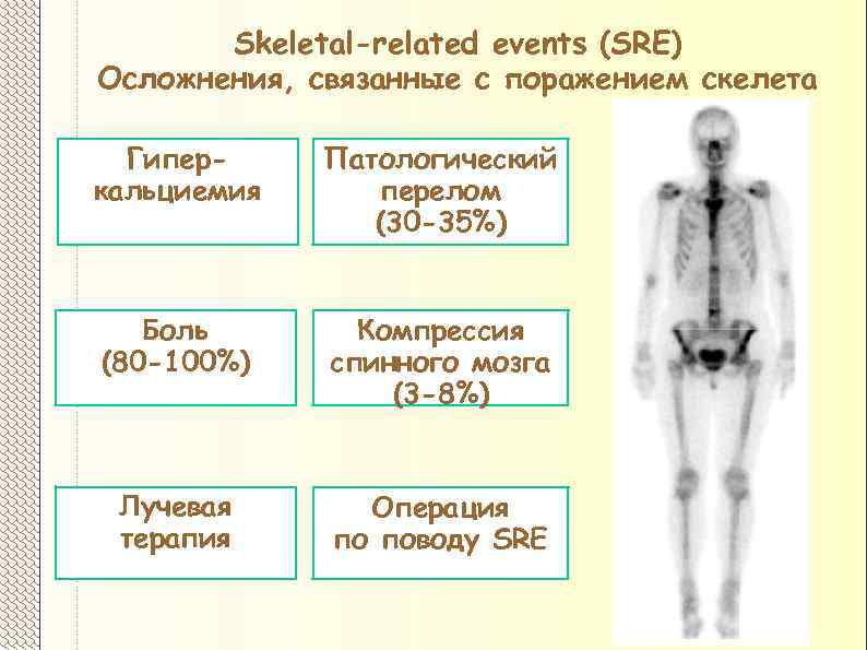 Сцинтиграфическая картина метастатического поражения костей скелета