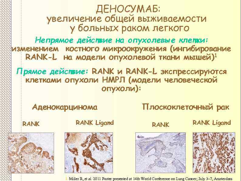 ДЕНОСУМАБ: увеличение общей выживаемости у больных раком легкого Непрямое действие на опухолевые клетки: изменением