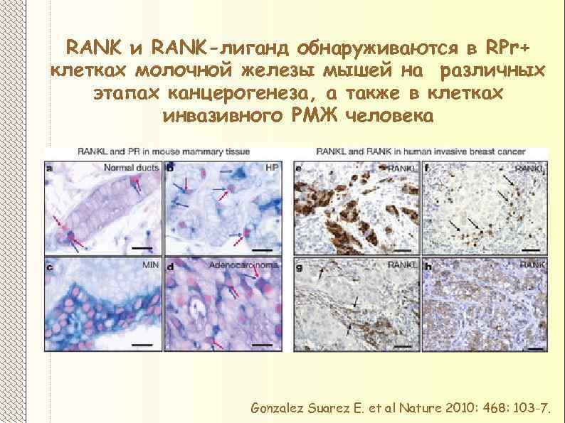 RANK и RANK-лиганд обнаруживаются в RPr+ клетках молочной железы мышей на различных этапах канцерогенеза,