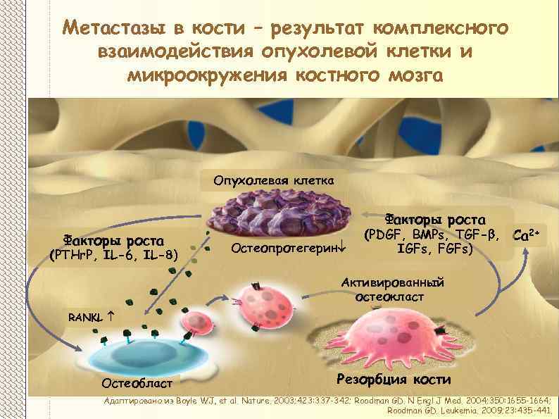 Метастазы костей лечение прогноз