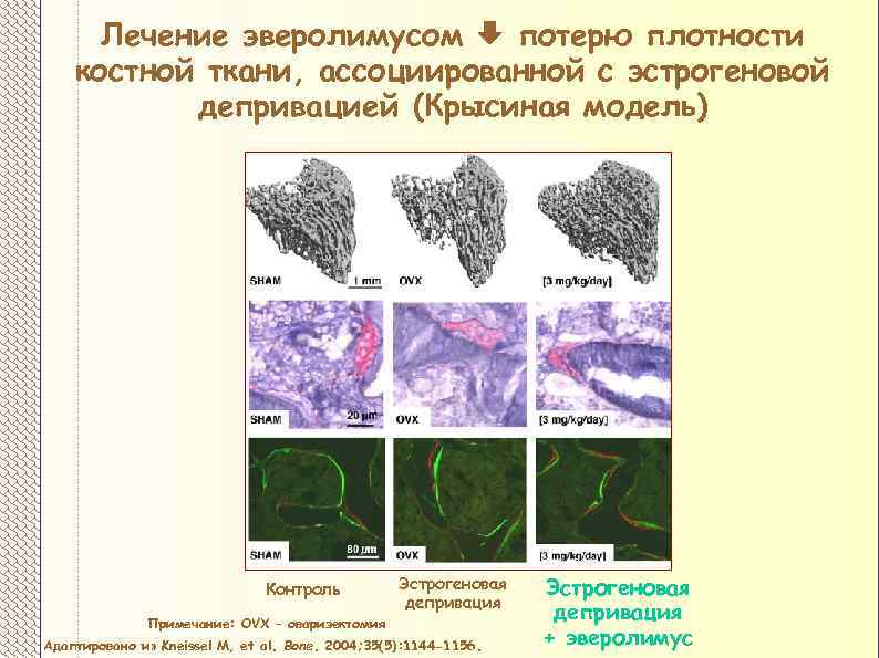 Лечение эверолимусом потерю плотности костной ткани, ассоциированной с эстрогеновой депривацией (Крысиная модель) Контроль Эстрогеновая