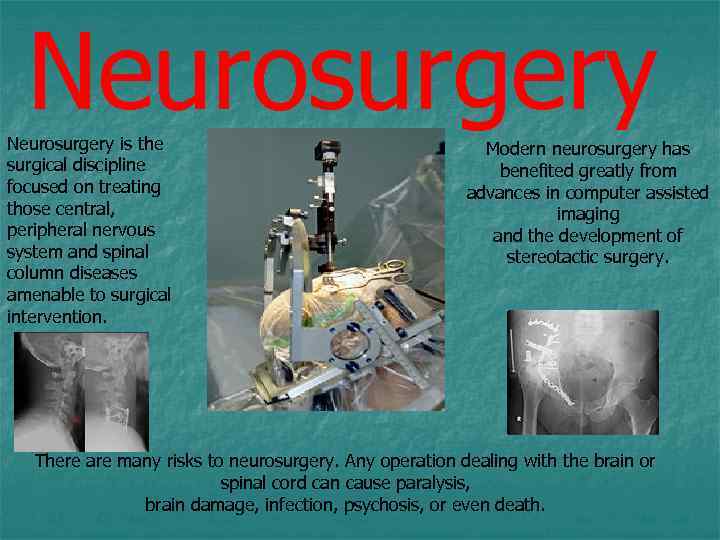 Neurosurgery is the surgical discipline focused on treating those central, peripheral nervous system and