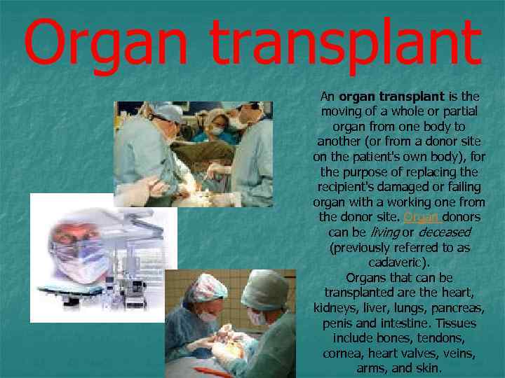 Organ transplant An organ transplant is the moving of a whole or partial organ