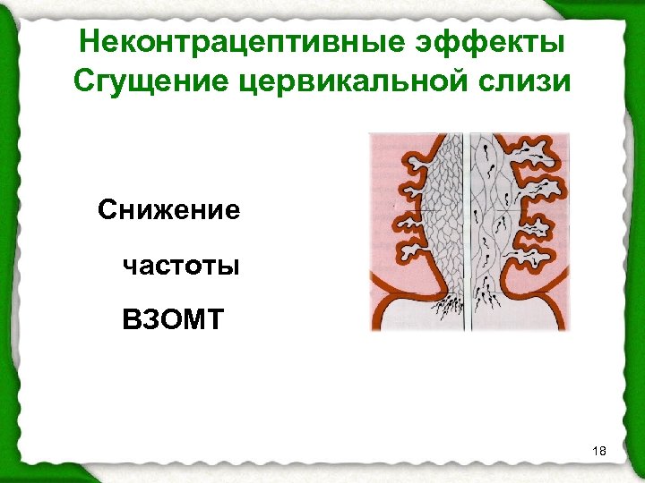 Неконтрацептивные эффекты Сгущение цервикальной слизи Снижение частоты ВЗОМТ 18 