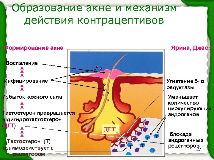 Образование акне и механизм действия контрацептивов Формирование акне Ярина, Джес: Воспаление ^ ^ ^
