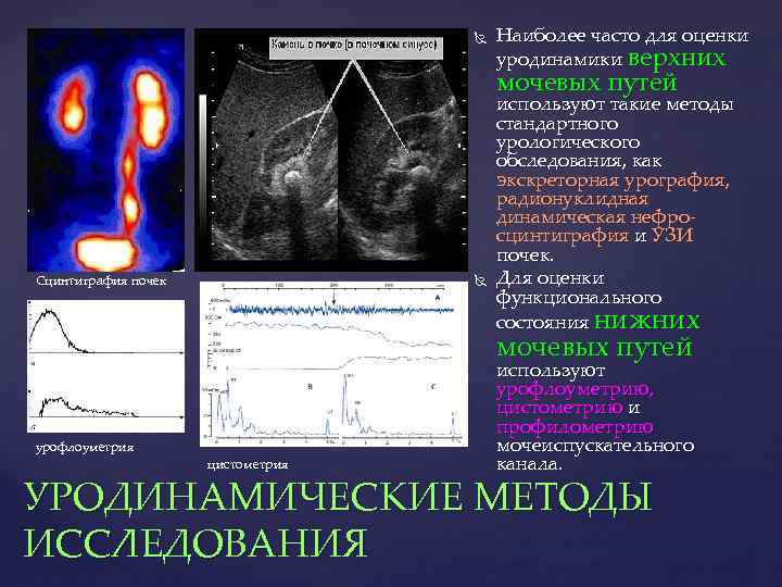  Наиболее часто для оценки уродинамики верхних мочевых путей Сцинтиграфия почек используют такие методы