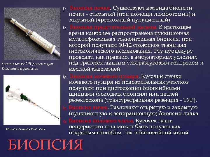  ректальный УЗ-датчик для биопсии простаты Тонкоигольная биопсия Биопсия почки. Существуют два вида биопсии