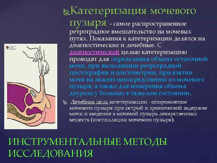 Катетеризация мочевого пузыря - самое распространенное ретроградное вмешательство на мочевых путях. Показания к катетеризации