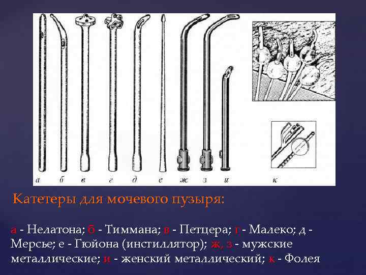Катетеры для мочевого пузыря: а - Нелатона; б - Тиммана; в - Петцера; г