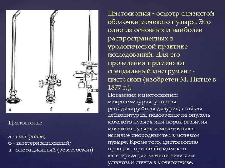 Цистоскопия - осмотр слизистой оболочки мочевого пузыря. Это одно из основных и наиболее распространенных
