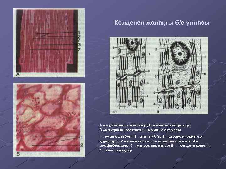Көлденең жолақты б/е ұлпасы А – жұмысшы миоциттер; Б –атиптік миоциттер; В –ультрамикроскоптық құрылыс