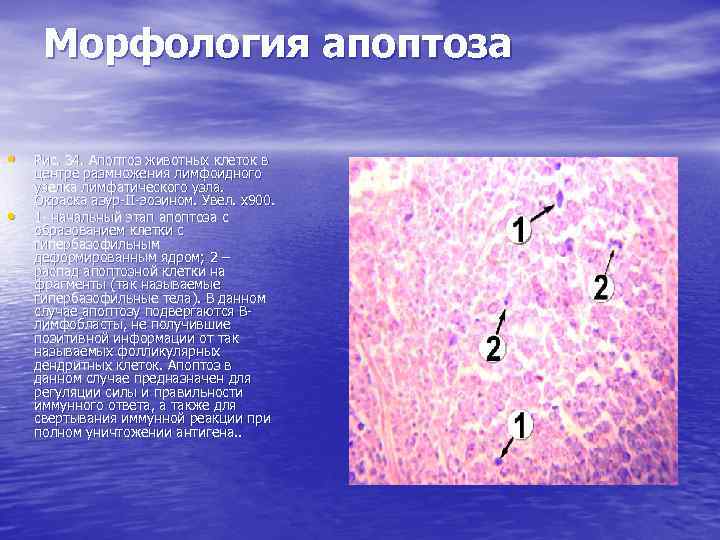 Морфология апоптоза • • Рис. 34. Апоптоз животных клеток в центре размножения лимфоидного узелка