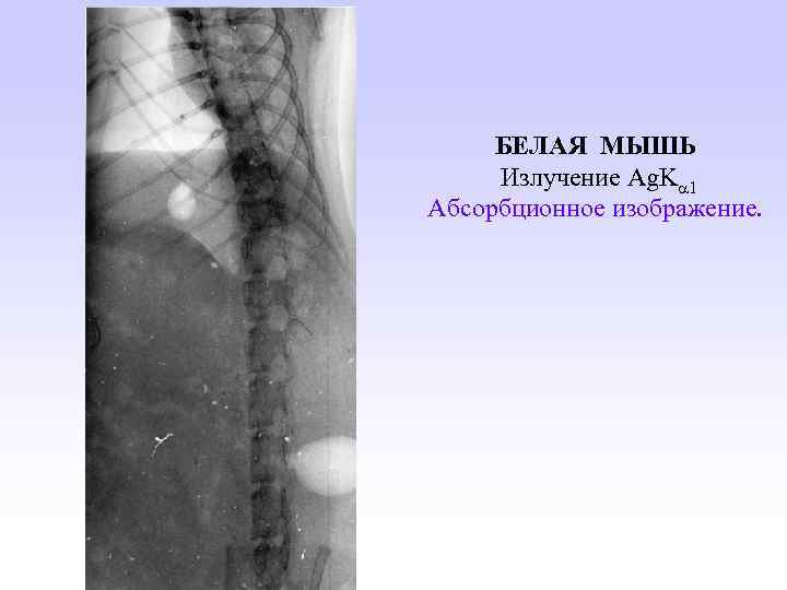 БЕЛАЯ МЫШЬ Излучение Ag. K 1 Абсорбционное изображение. 