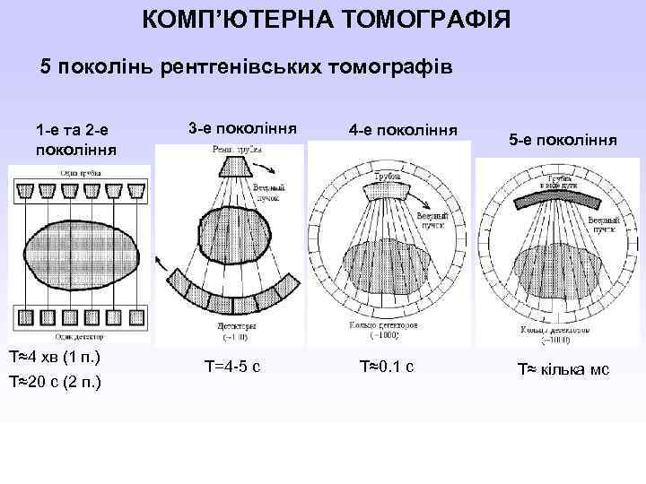 КОМП’ЮТЕРНА ТОМОГРАФІЯ 5 поколінь рентгенівських томографів 1 -е та 2 -е покоління Т≈4 хв