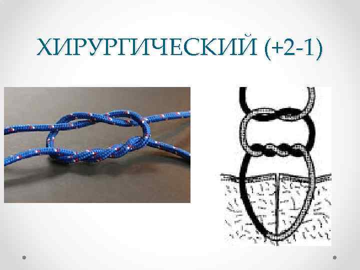 ХИРУРГИЧЕСКИЙ (+2 -1) 