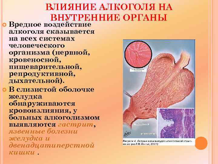 ВЛИЯНИЕ АЛКОГОЛЯ НА ВНУТРЕННИЕ ОРГАНЫ Вредное воздействие алкоголя сказывается на всех системах человеческого организма