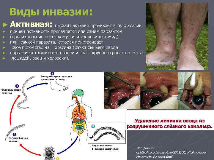 Виды инвазии: ► Активная: паразит активно проникает в тело хозяин, ► ► ► причем