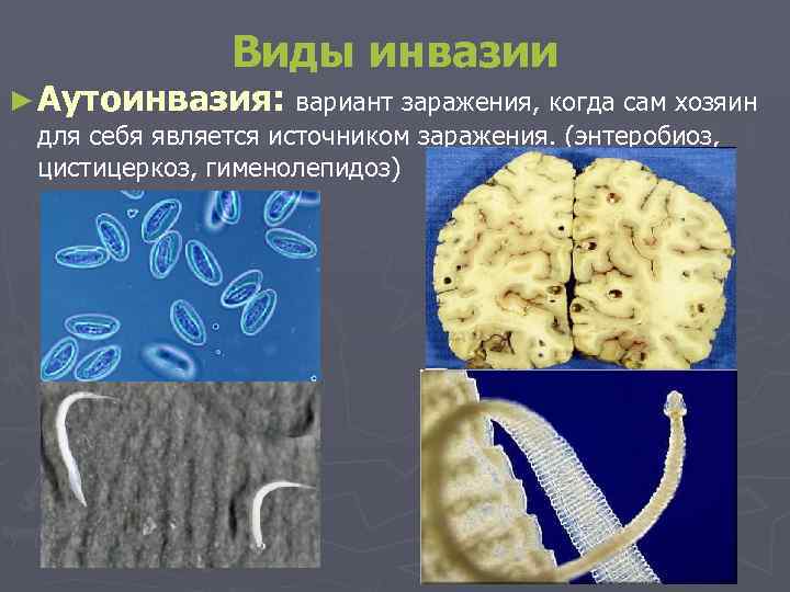 Виды инвазии ► Аутоинвазия: вариант заражения, когда сам хозяин для себя является источником заражения.