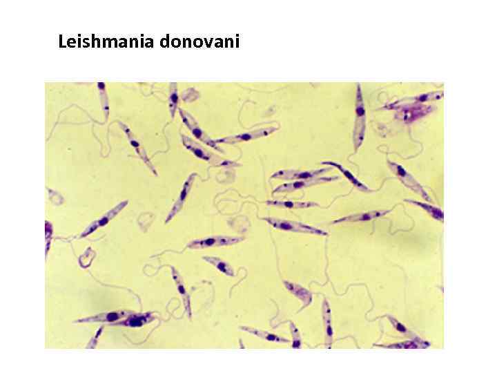 Leishmania donovani 