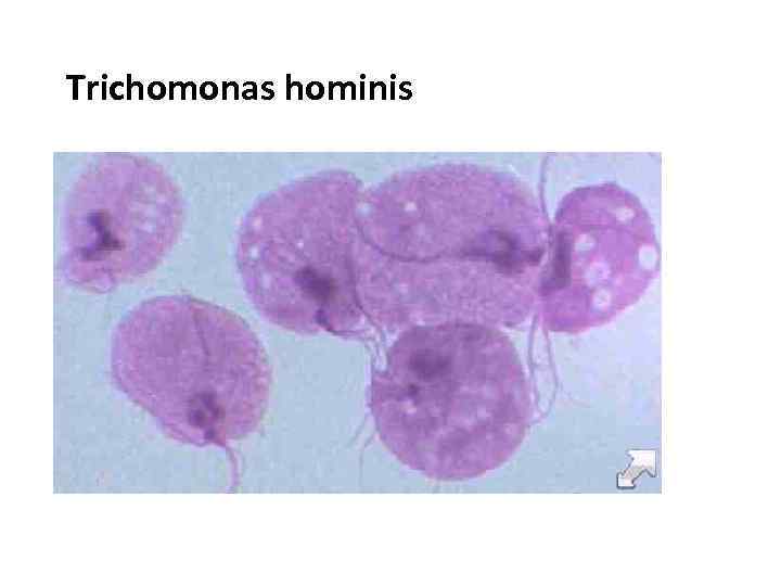 Trichomonas hominis 