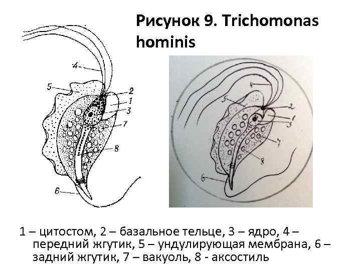 Рисунок 9. Trichomonas hominis 1 – цитостом, 2 – базальное тельце, 3 – ядро,