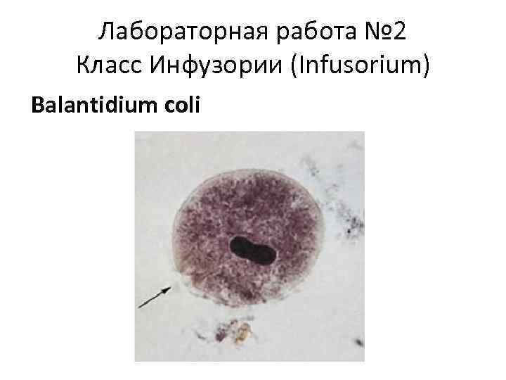 Лабораторная работа № 2 Класс Инфузории (Infusorium) Balantidium coli 