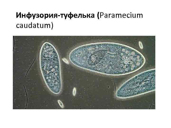 Инфузория-туфелька (Paramecium caudatum) 