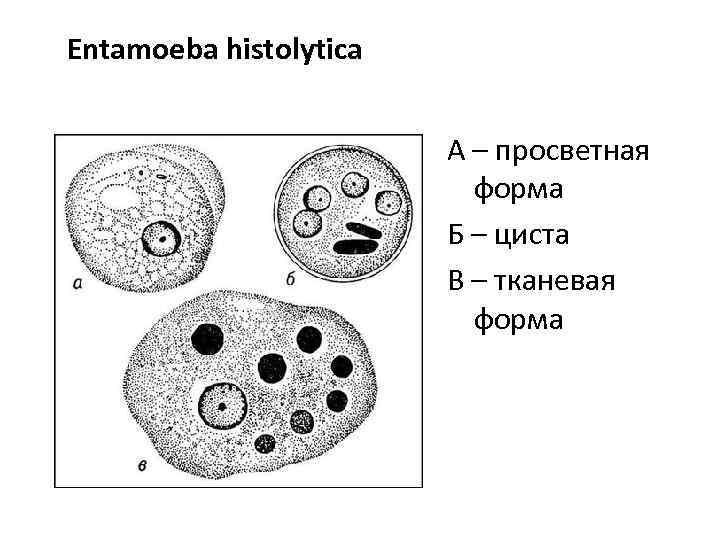 Entamoeba histolytica А – просветная форма Б – циста В – тканевая форма 