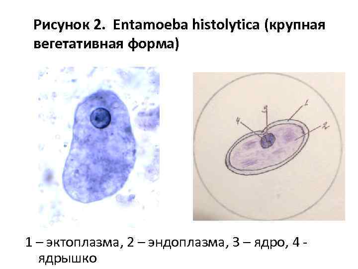 Рисунок 2. Entamoeba histolytica (крупная вегетативная форма) 1 – эктоплазма, 2 – эндоплазма, 3