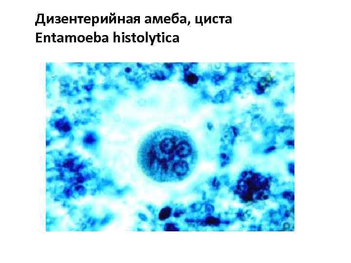 Дизентерийная амеба, циста Entamoeba histolytica 