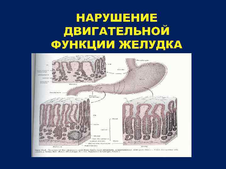 Нарушение моторной функции кишечника