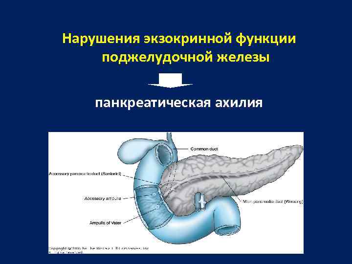 Нарушения экзокринной функции поджелудочной железы панкреатическая ахилия 