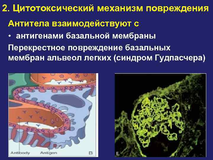 2. Цитотоксический механизм повреждения Антитела взаимодействуют с • антигенами базальной мембраны Перекрестное повреждение базальных