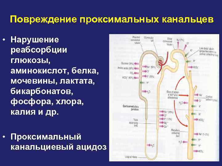 Повреждение проксимальных канальцев • Нарушение реабсорбции глюкозы, аминокислот, белка, мочевины, лактата, бикарбонатов, фосфора, хлора,