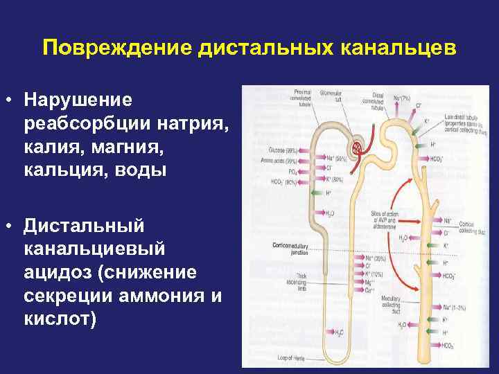 Повреждение дистальных канальцев • Нарушение реабсорбции натрия, калия, магния, кальция, воды • Дистальный канальциевый