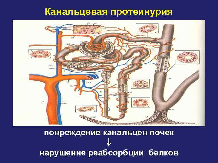 Нарушение моторной функции кишечника