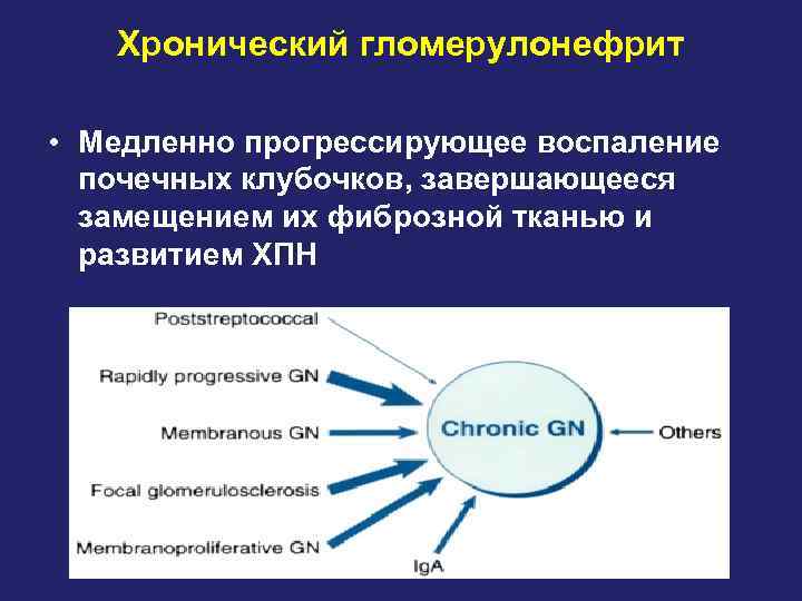 Хронический гломерулонефрит • Медленно прогрессирующее воспаление почечных клубочков, завершающееся замещением их фиброзной тканью и