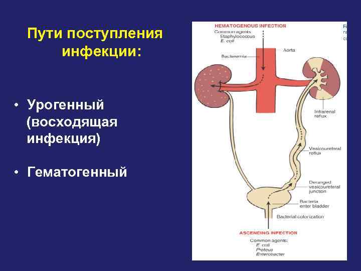 Пути поступления инфекции: • Урогенный (восходящая инфекция) • Гематогенный 