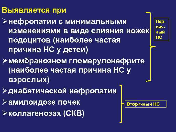 Выявляется при ПерØ нефропатии с минимальными вичизменениями в виде слияния ножек ный НС подоцитов