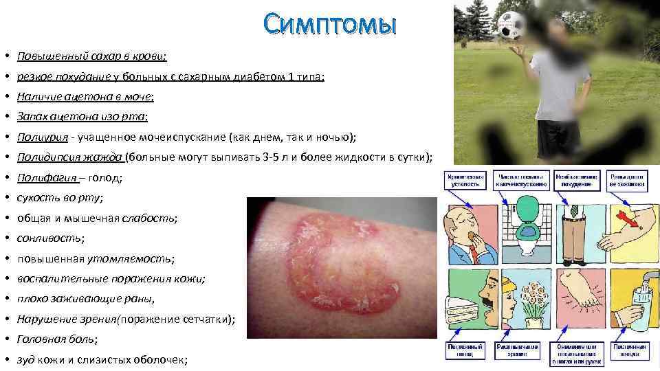 Симптомы • Повышенный сахар в крови; • резкое похудание у больных с сахарным диабетом