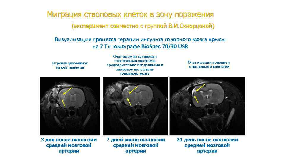 Миграция стволовых клеток в зону поражения (эксперимент совместно с группой В. И. Скворцовой) Визуализация