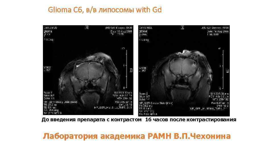 Glioma С 6, в/в липосомы with Gd До введения препарата с контрастом 16 часов