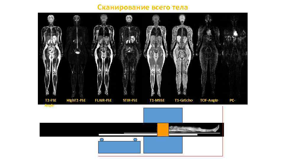 Сканирование всего тела T 2 -FSE Angio High. T 2 -FSE FLAIR-FSE STIR-FSE T